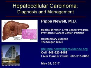 Hepatocellular Carcinoma Diagnosis and Management Pippa Newell M