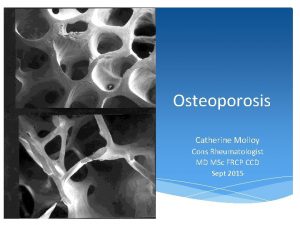 Osteoporosis Catherine Molloy Cons Rheumatologist MD MSc FRCP