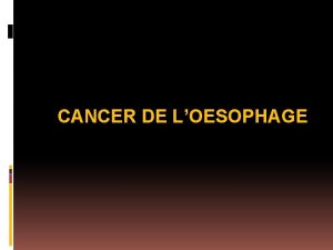 CANCER DE LOESOPHAGE PLAN I INTRODUCTION II RAPPEL