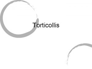 Torticollis What is it Also known as Wryneck