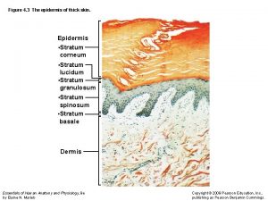 Figure 4 3 The epidermis of thick skin