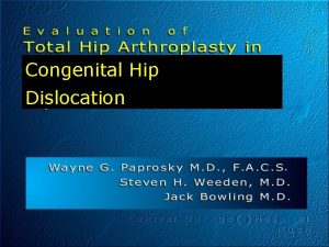 Congenital Hip Dislocation Introduction THA in the DDH