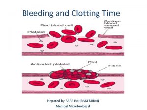 Bleeding and Clotting Time Prepared by SARA BAHRAM
