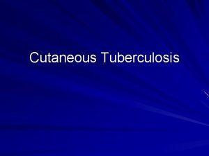 Cutaneous Tuberculosis Mycobacterium There approximately 30 species of