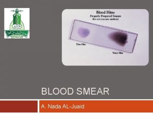 BLOOD SMEAR A Nada ALJuaid Definition A blood