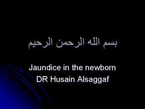 Jaundice in the newborn DR Husain Alsaggaf Jaundice