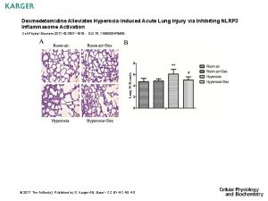 Dexmedetomidine Alleviates HyperoxiaInduced Acute Lung Injury via Inhibiting