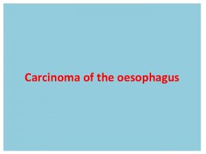 Carcinoma of the oesophagus Squamous oesophageal cancer is