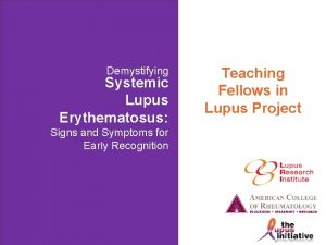 Demystifying Systemic Lupus Erythematosus Signs and Symptoms for