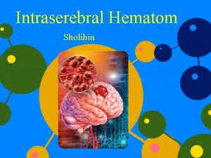 Intraserebral Hematom Sholihin Anatomi Otak Definisi Adalah perdarahan