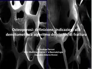 Osteoporosi definizione indicazioni alla densitometria e algoritmo del