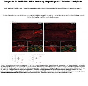 Progranulin Deficient Mice Develop Nephrogenic Diabetes Insipidus Hardt