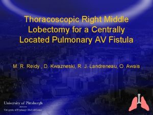 Thoracoscopic Right Middle Lobectomy for a Centrally Located