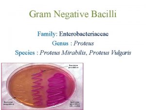 Gram Negative Bacilli Family Enterobacteriaceae Genus Proteus Species