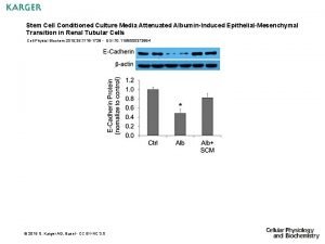 Stem Cell Conditioned Culture Media Attenuated AlbuminInduced EpithelialMesenchymal