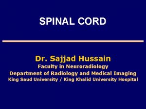 SPINAL CORD Dr Sajjad Hussain Faculty in Neuroradiology