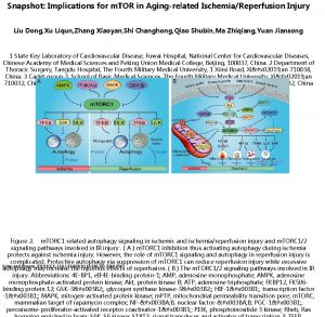 Snapshot Implications for m TOR in Agingrelated IschemiaReperfusion