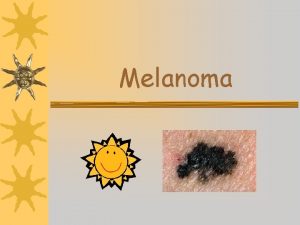 Melanoma Melanocytes When skin is exposed to sunlight