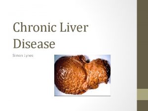 Chronic Liver Disease Simon Lynes Definition Progressive destruction
