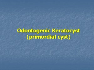 Odontogenic Keratocyst primordial cyst Odontogenic Keratocyst n Peak