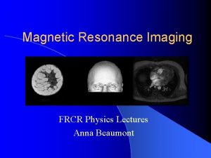 Magnetic Resonance Imaging FRCR Physics Lectures Anna Beaumont