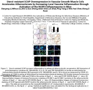 Sterolresistant SCAP Overexpression in Vascular Smooth Muscle Cells