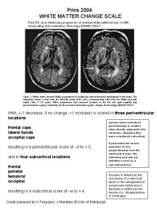 Prins 2004 WHITE MATTER CHANGE SCALE Prins ND