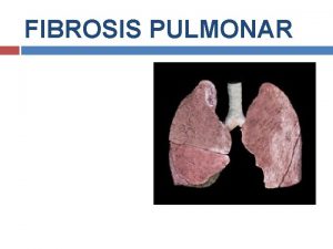 FIBROSIS PULMONAR DEFINICION Se entiende como fibrosis pulmonar