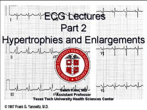 ECG Lectures Part 2 Hypertrophies and Enlargements Selim