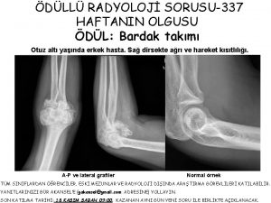 DLL RADYOLOJ SORUSU337 HAFTANIN OLGUSU DL Bardak takm