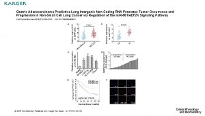 Gastric Adenocarcinoma Predictive Long Intergenic NonCoding RNA Promotes