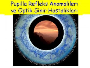 Pupilla Refleks Anomalileri ve NroOftalmoloji Optik Sinir Hastalklar