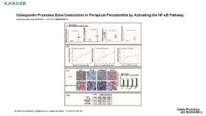 Osteopontin Promotes Bone Destruction in Periapical Periodontitis by