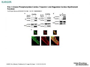 Pim1 Kinase Phosphorylates Cardiac Troponin I and Regulates