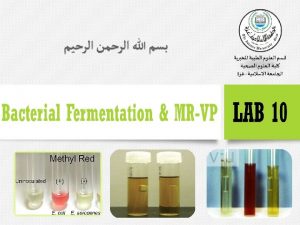 Bacterial Fermentation v Microbial metabolic processes are complex