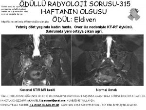 DLL RADYOLOJ SORUSU315 HAFTANIN OLGUSU DL Eldiven dll