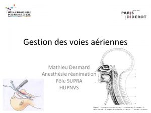 Gestion des voies ariennes Mathieu Desmard Anesthsie ranimation