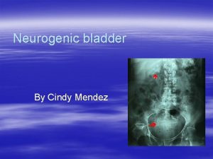 Neurogenic bladder By Cindy Mendez ETIOLOGY Loss of