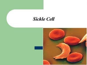 Sickle Cell Mohammed laqqan Introduction l Sickle Cell