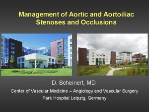 Management of Aortic and Aortoiliac Stenoses and Occlusions