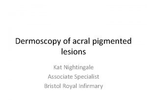 Dermoscopy of acral pigmented lesions Kat Nightingale Associate