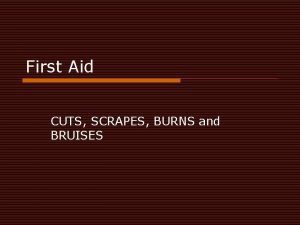 First Aid CUTS SCRAPES BURNS and BRUISES WOUNDS