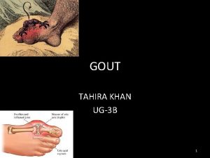 GOUT TAHIRA KHAN UG3 B 1 INTRODUCTION GOUT