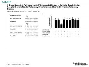 A Single Nucleotide Polymorphism in 3 Untranslated Region