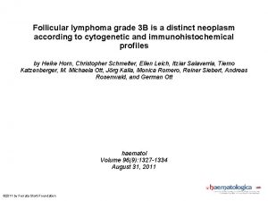 Follicular lymphoma grade 3 B is a distinct