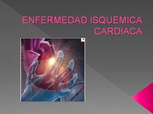 ENFERMEDAD ISQUEMICA CARDIACA ISQUEMIA DE MIOCARDIO RIEGO SANGUNEO