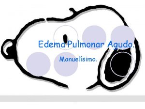 Edema Pulmonar Agudo Manuelsimo Objetivos l Definicin l