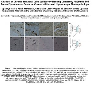 A Model of Chronic Temporal Lobe Epilepsy Presenting