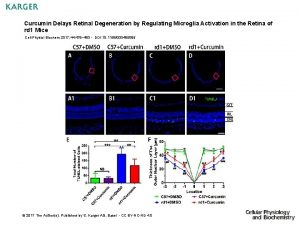 Curcumin Delays Retinal Degeneration by Regulating Microglia Activation