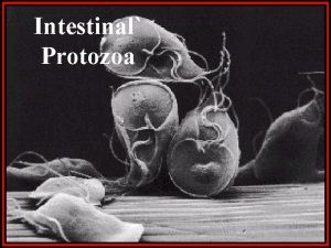 Intestinal Protozoa Giardia lamblia Giardia trophozoites SEM Giardia